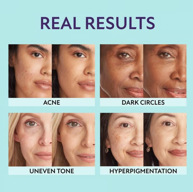 SUPREME CRÈME – All-in-one moisturizer, concealer & coverage 💧✨ Lightweight & waterproof