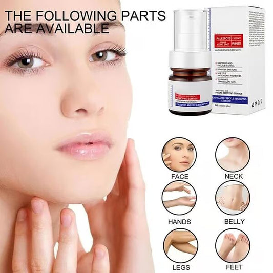 🔥Vitamin C Whitening Freckles Face Cream Remove Melasma Dark Spots Lighten Melanin
