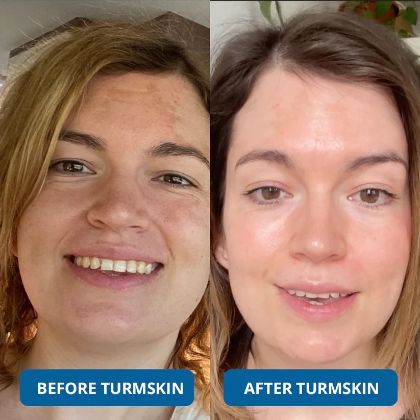 💧 3% Hyaluronic Acid Ultra-Hydrating Serum Flood Your Skin With Glass-Skin Hydration Instantly ✨