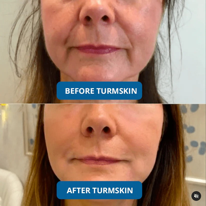 💧 3% Hyaluronic Acid Ultra-Hydrating Serum Flood Your Skin With Glass-Skin Hydration Instantly ✨