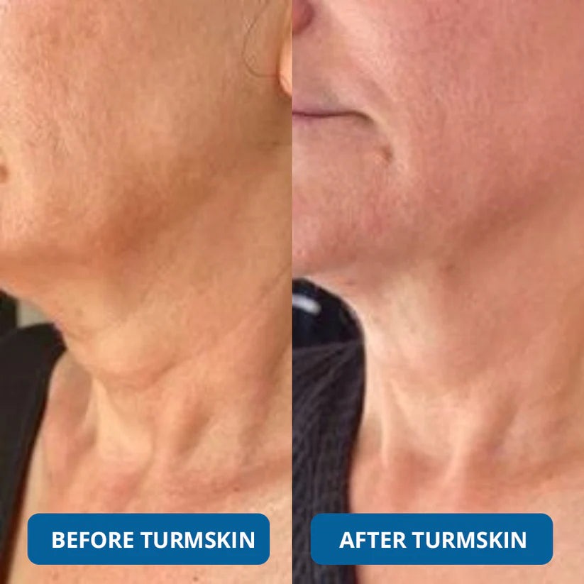 💧 3% Hyaluronic Acid Ultra-Hydrating Serum Flood Your Skin With Glass-Skin Hydration Instantly ✨