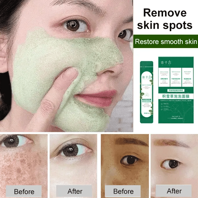 CENTELLA ASIATICA BUBBLE MASK