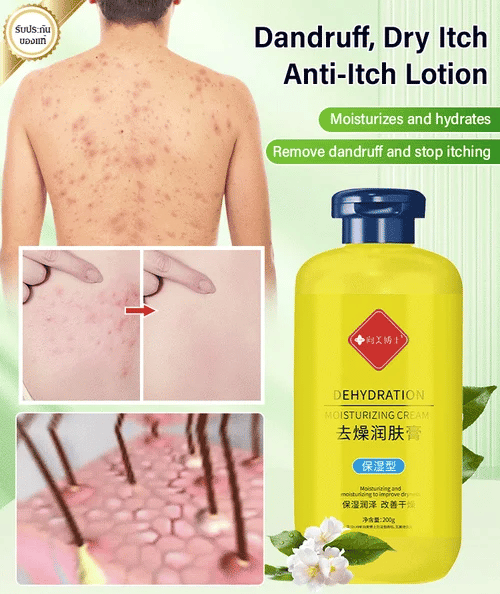 [Developed for Fall/Winter] Anti-Itch Moisturizer