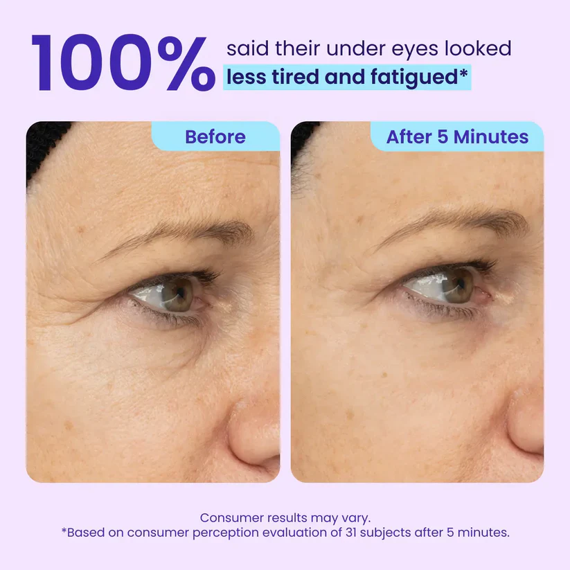 ✨Last Day 50% Off  Erase Eye Bags in Minutes — Look Refreshed Instantly