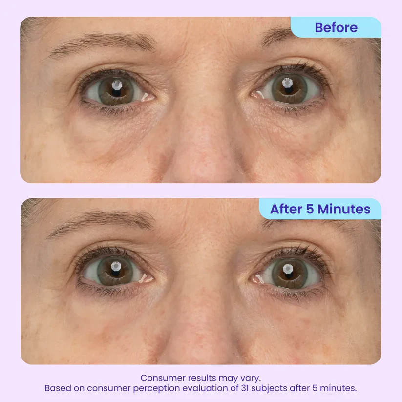 ✨Last Day 50% Off  Erase Eye Bags in Minutes — Look Refreshed Instantly