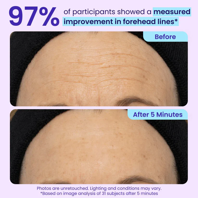 ✨Last Day 50% Off  Erase Eye Bags in Minutes — Look Refreshed Instantly
