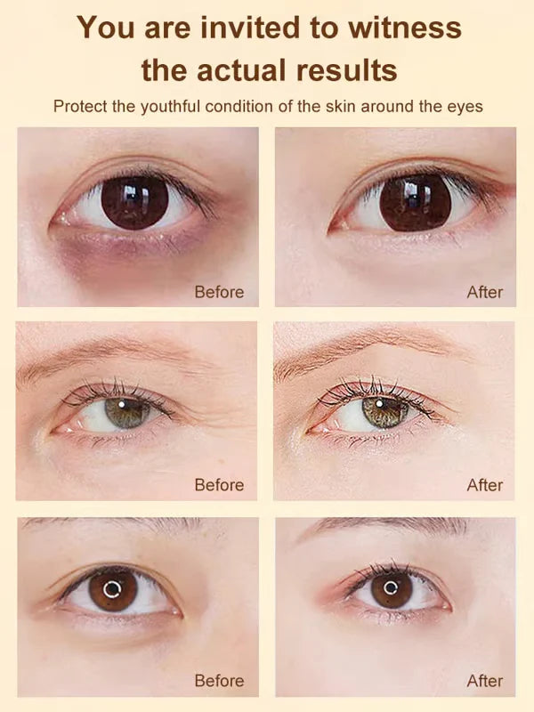 🔥BUY 1 GET 1 FREEVC🔥 Lutein Eye Essence Oil