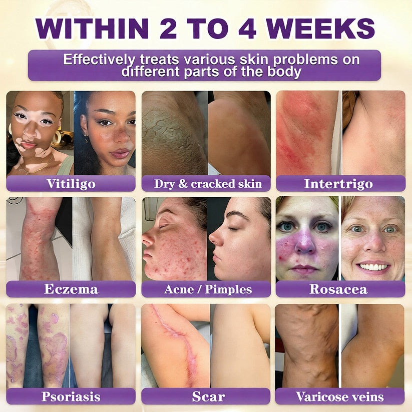 🔥LAST DAY 50% OFF - QIAWI® Biotin 10-in-1 Skin Restoration Cream