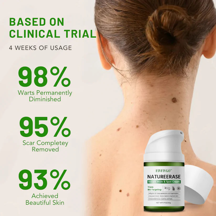 ✅ Official Store: Fivfivgo™ NatureErase Instant Mole & Spot Cream