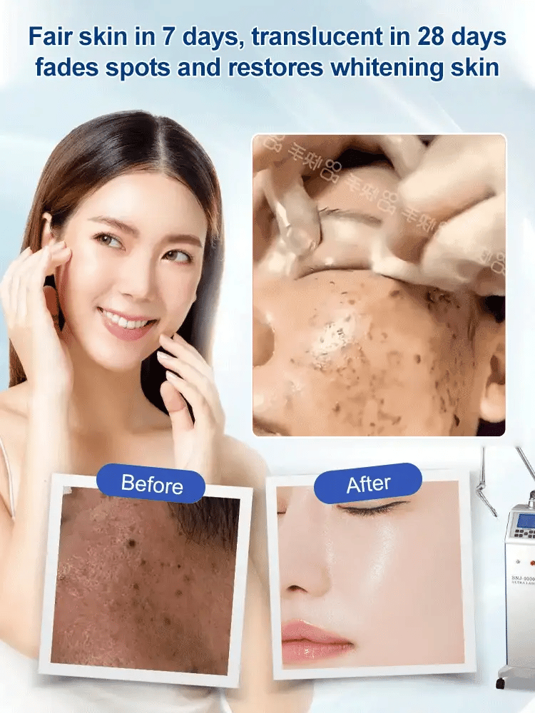 🔥Last Day Buy 1 Get 1 Free-Spot Fading Urea Cream