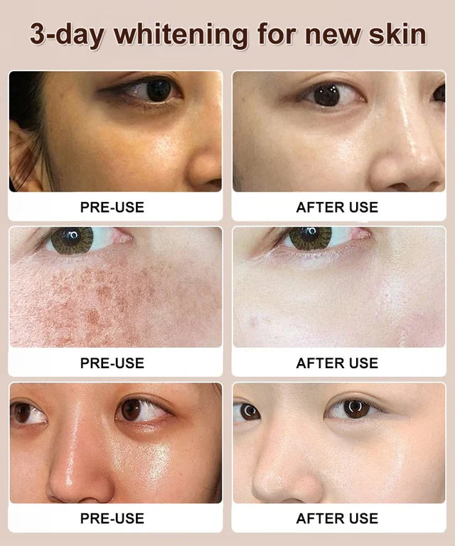 🔥Last Day Buy Two Get One Free🔥NIACINAMIDE PURIFYING WHITENING CLEANSER