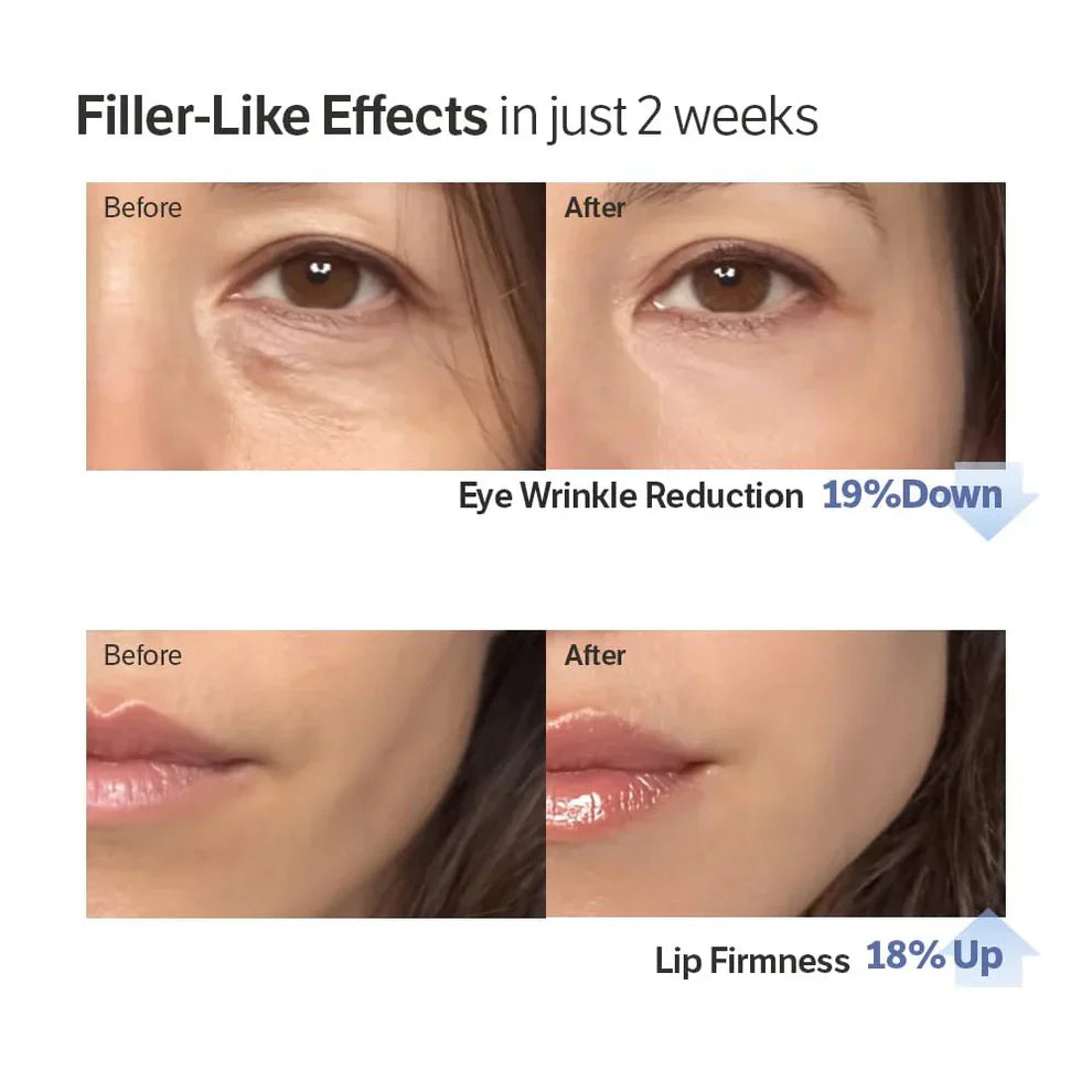 ⏰ Last 3 Hours! 🔥 Buy 1 Get 1 Free Deep Collagen Cream In Serum
