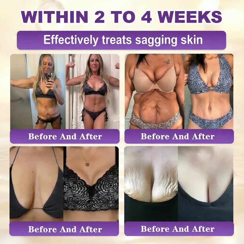 🔥LAST DAY 50% OFF - QIAWI® Biotin 10-in-1 Skin Restoration Cream