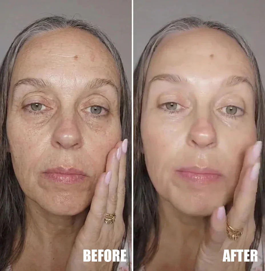 ⏰ Last 3 Hours! 🔥 Buy 1 Get 1 Free Deep Collagen Cream In Serum