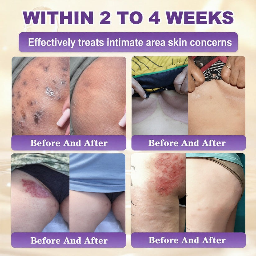 🔥LAST DAY 50% OFF - QIAWI® Biotin 10-in-1 Skin Restoration Cream