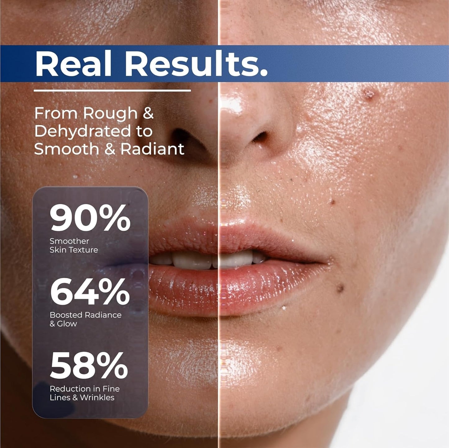 💧 3% Hyaluronic Acid Ultra-Hydrating Serum Flood Your Skin With Glass-Skin Hydration Instantly ✨