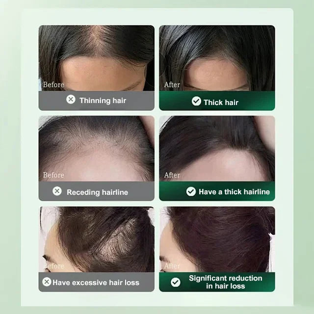 2025 NEW ANTI-HAIR LOSS AND HAIR GROWTH SOLUTION