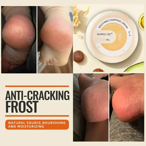 🎁SALE-49% OFF🎁Anti-Cracking Frost