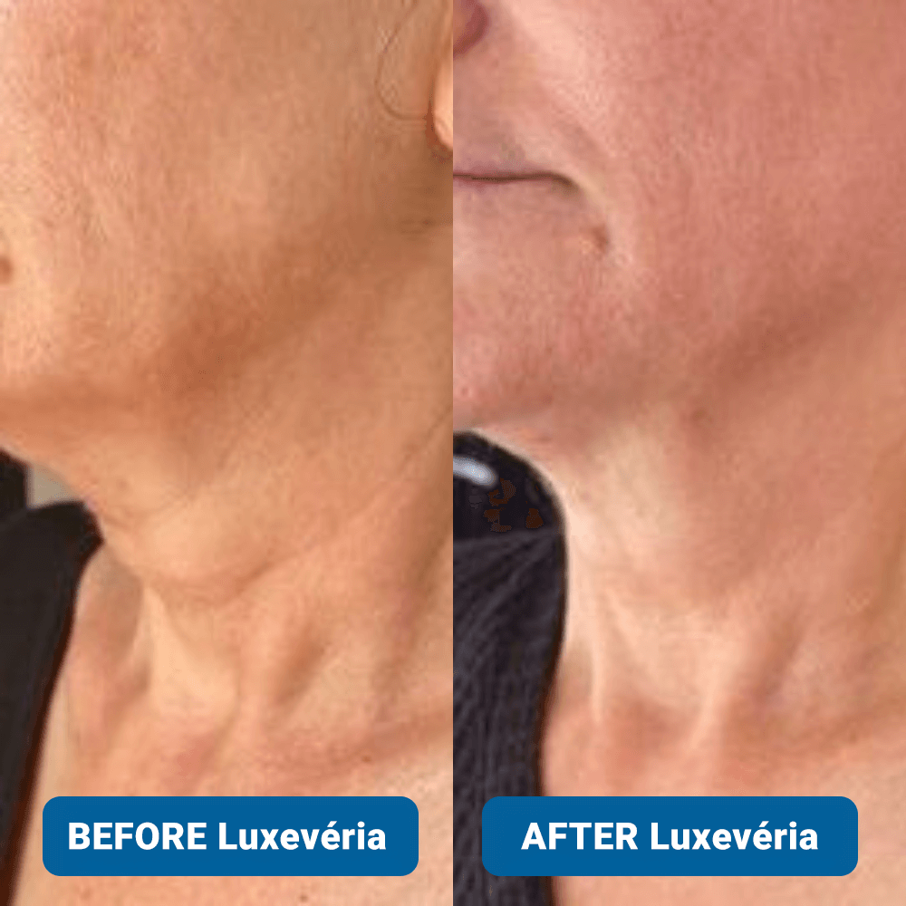 ✨ Last Day Buy 1 Get 1 Free ✨3% Hyaluronic Acid Ultra Hydrating Serum by Luxevéria