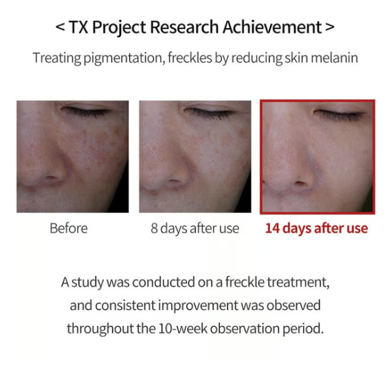 TX Cream -for Dark Spots & Hyperpigmentation