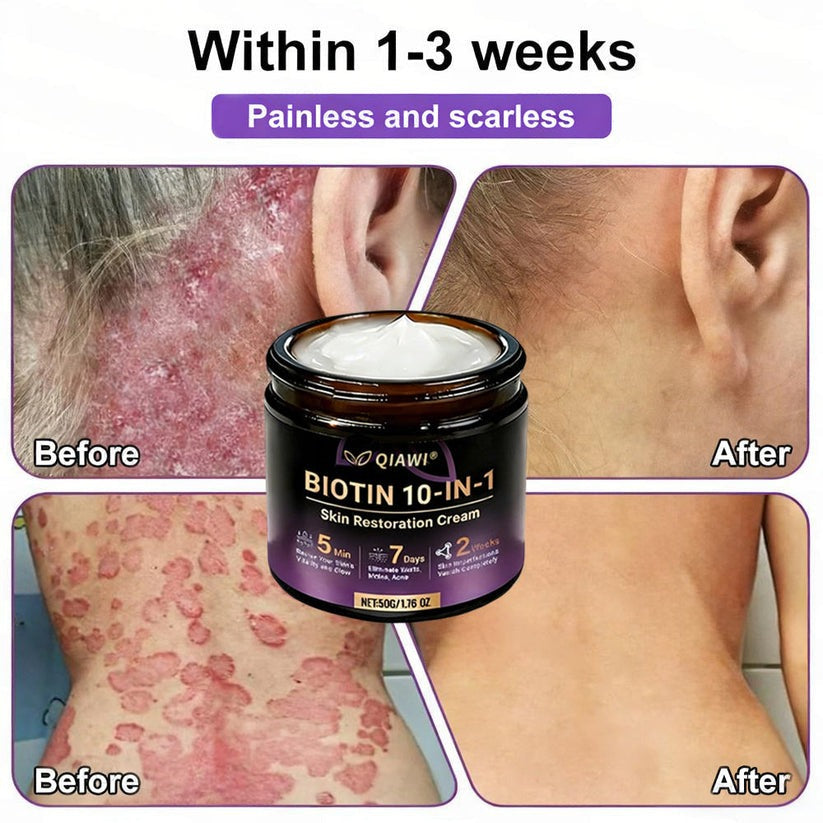 🔥LAST DAY 50% OFF - QIAWI® Biotin 10-in-1 Skin Restoration Cream