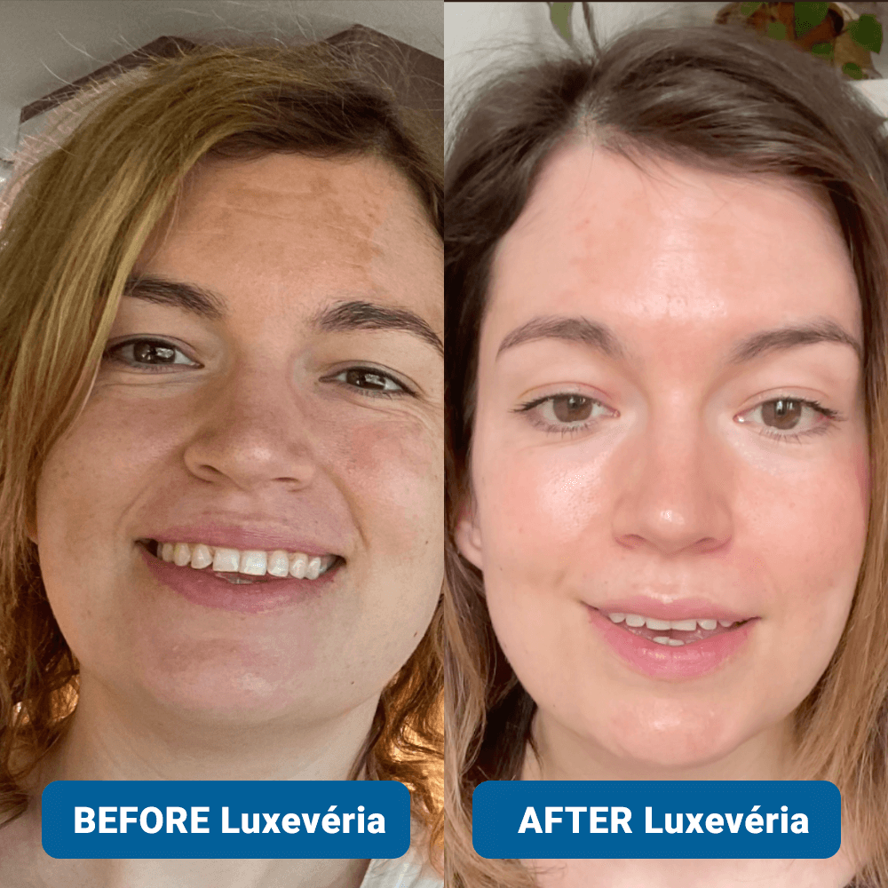 ✨ Last Day Buy 1 Get 1 Free ✨3% Hyaluronic Acid Ultra Hydrating Serum by Luxevéria