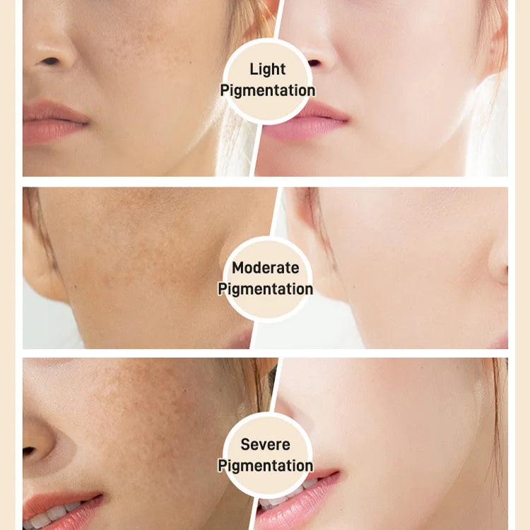 Intensive Whitening and Anti-Blemish Serum Oil