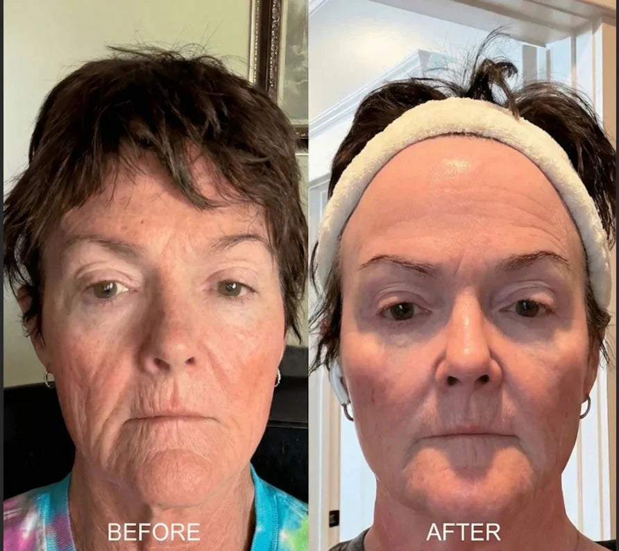 ⏰ Last 3 Hours! 🔥 Buy 1 Get 1 Free Deep Collagen Cream In Serum