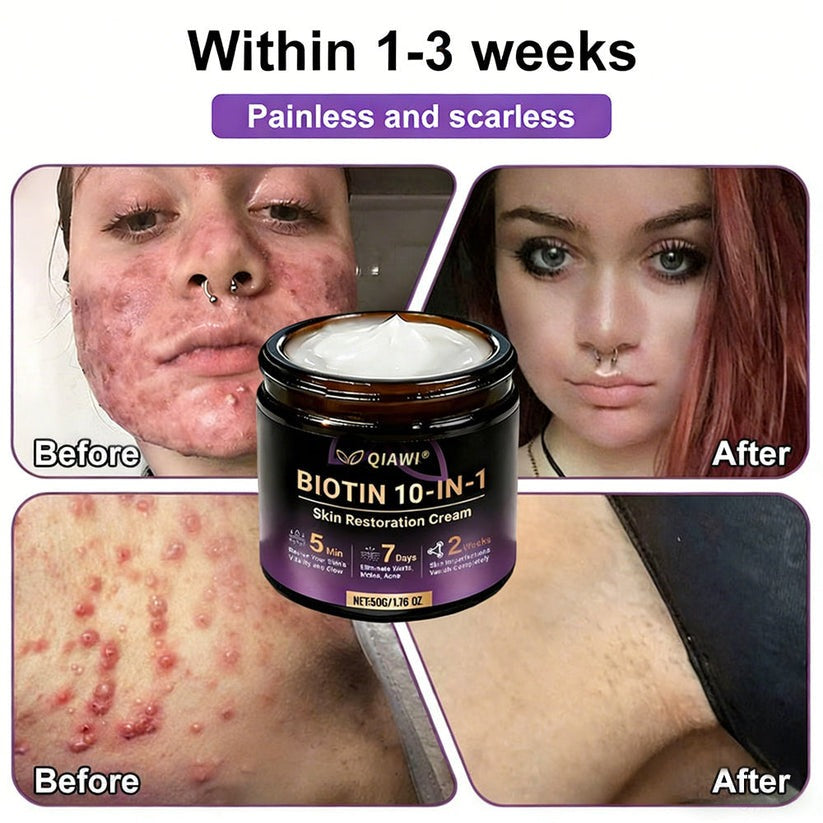 🔥LAST DAY 50% OFF - QIAWI® Biotin 10-in-1 Skin Restoration Cream
