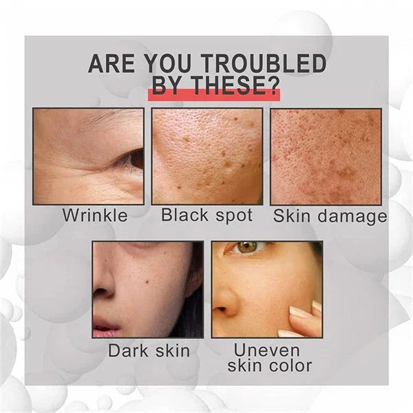 Last Day Promotion 49% OFF--2024 New Collagen Boost Anti-Aging Serum