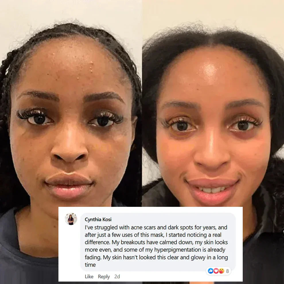 🔥Limited Time Offer🔥 — Buy 2 Collagen Night Masks, Get 1 Free! Wake Up to Youthful, Hydrated Skin!