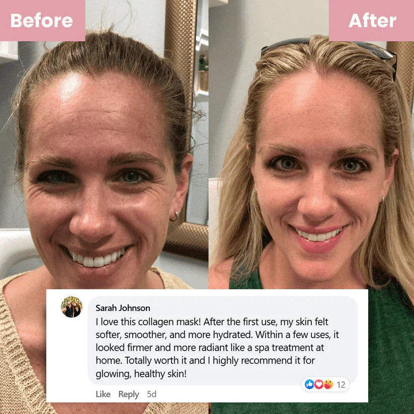 🔥Limited Time Offer🔥 — Buy 2 Collagen Night Masks, Get 1 Free! Wake Up to Youthful, Hydrated Skin!