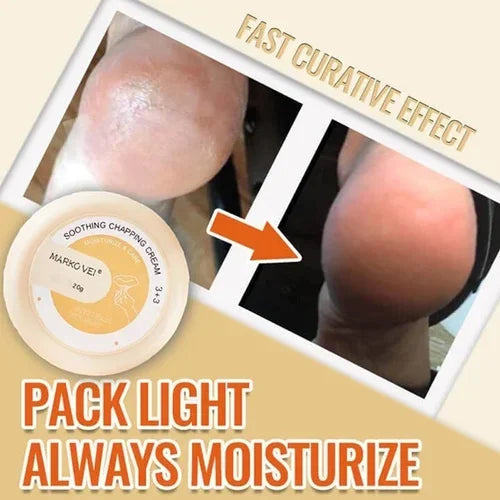 🎁SALE-49% OFF🎁Anti-Cracking Frost
