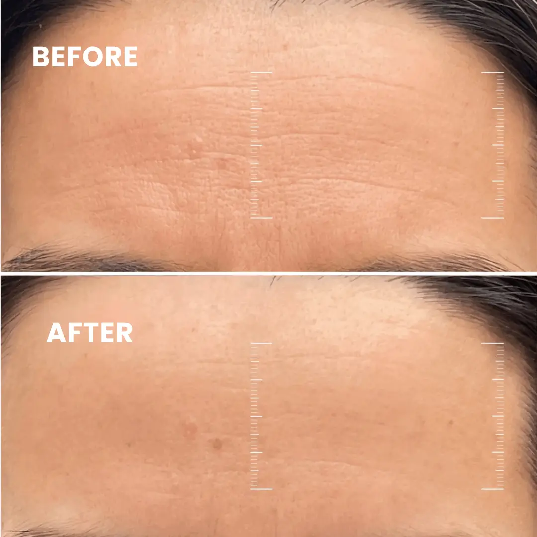 Buy 2 Collagen Night Masks, Get 1 Free! Wake Up to Youthful, Hydrated Skin!