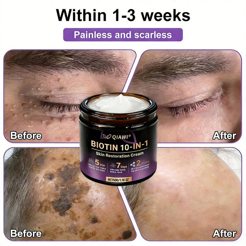 🔥LAST DAY 50% OFF - QIAWI® Biotin 10-in-1 Skin Restoration Cream