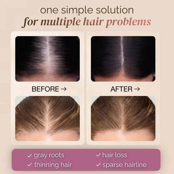 🔥BUY 1 GET 1 FREE🔥Hair Concealer – Instantly Covers Gray Roots &amp; Thinning Hair