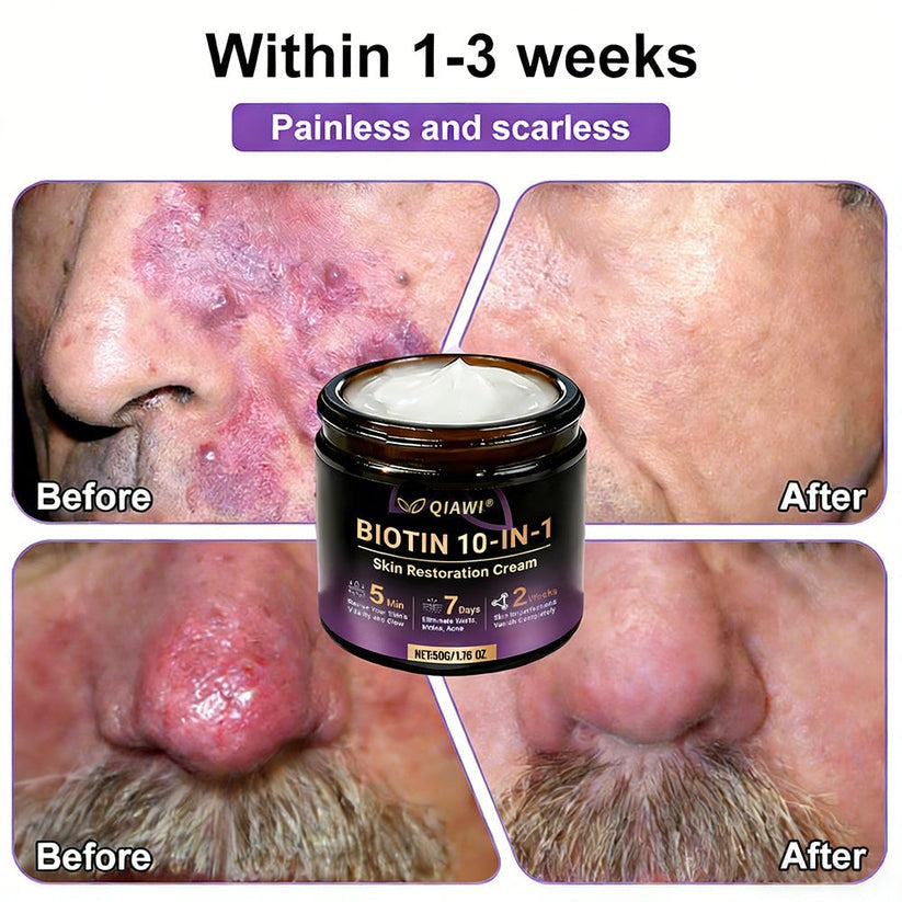🔥LAST DAY 50% OFF - QIAWI® Biotin 10-in-1 Skin Restoration Cream