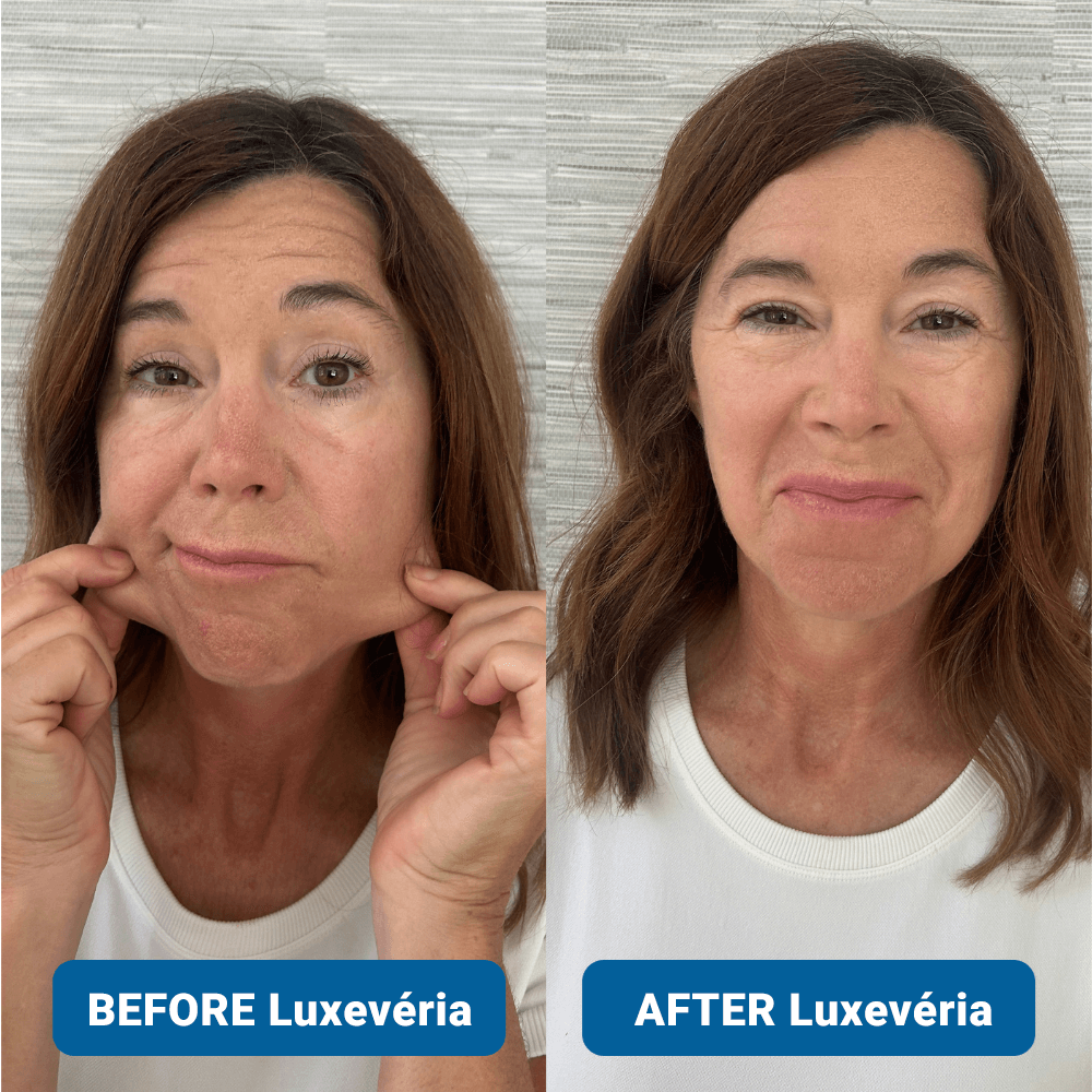 ✨ Last Day Buy 1 Get 1 Free ✨3% Hyaluronic Acid Ultra Hydrating Serum by Luxevéria