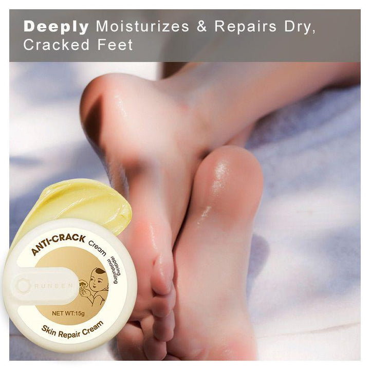 Cracked Skin Repair Cream