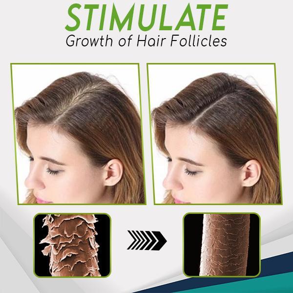HerbalRevive Hair Growth Essence Spray