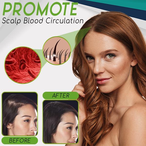 HerbalRevive Hair Growth Essence Spray