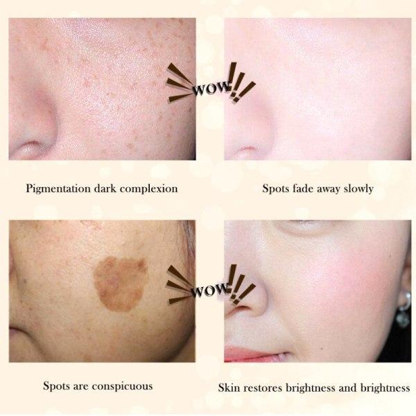 Instant Body Concealer