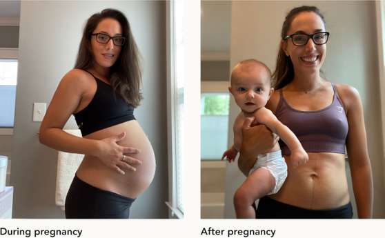 Prevent Stretch Marks with Maternity Cream