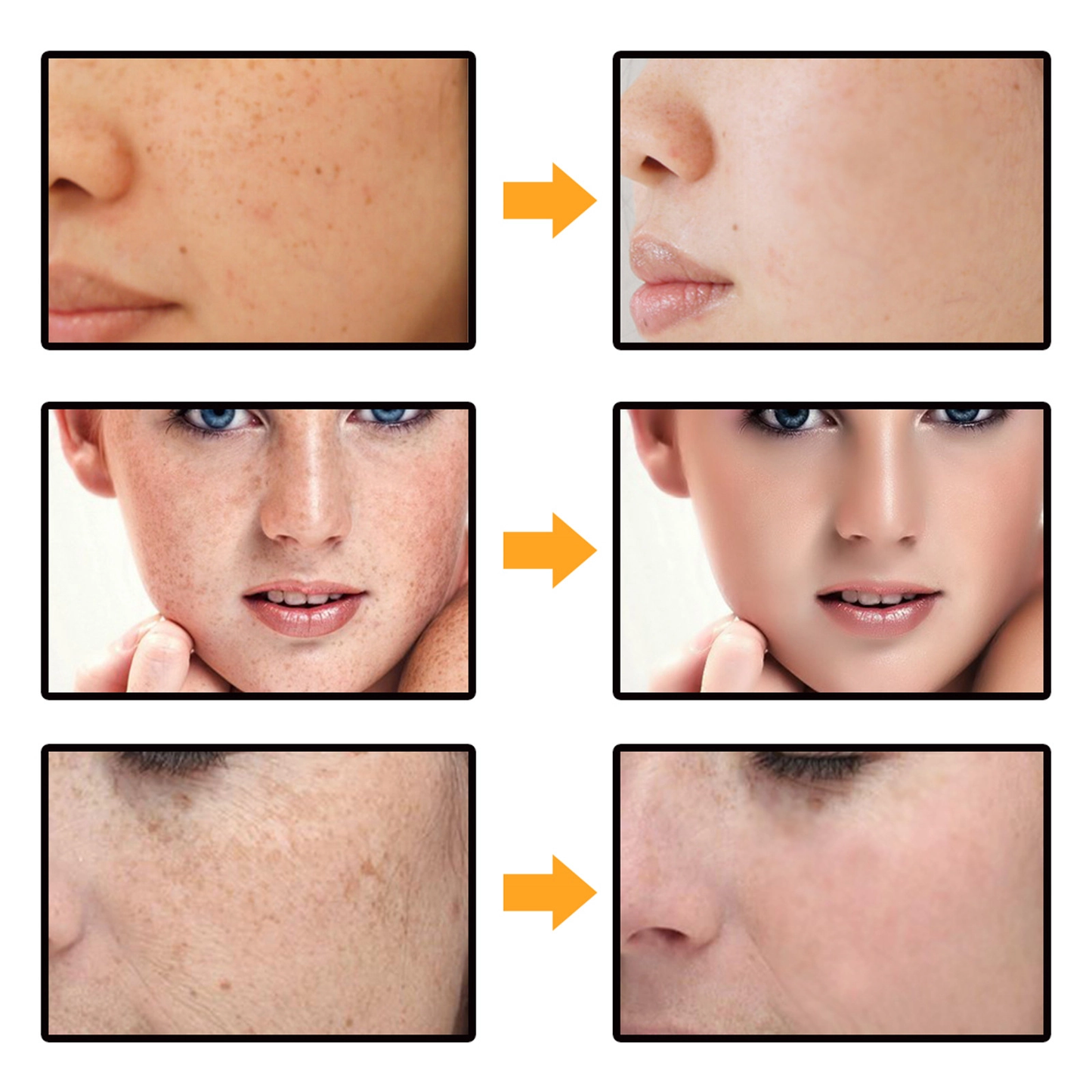 Dark Spot Corrector Face Body Cream