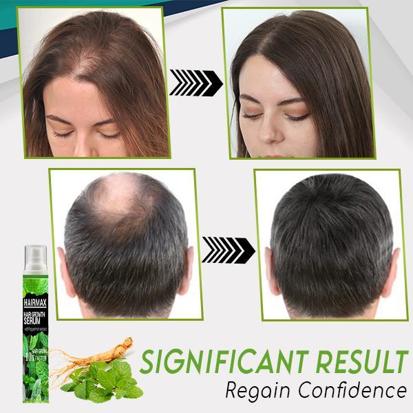 HerbalRevive Hair Growth Essence Spray