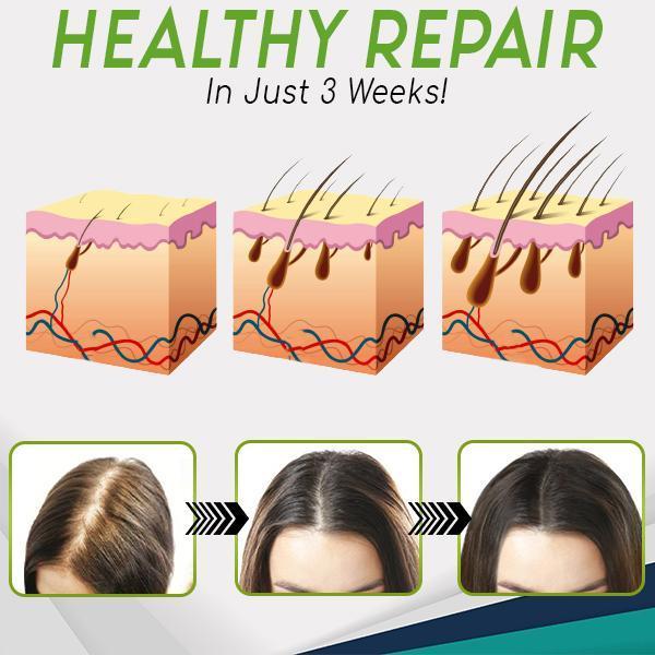 HerbalRevive Hair Growth Essence Spray