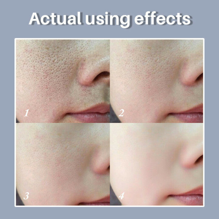 🔥 Last Day 49% OFF-2025 New Magical Perfecting Base Face Primer Under Foundation