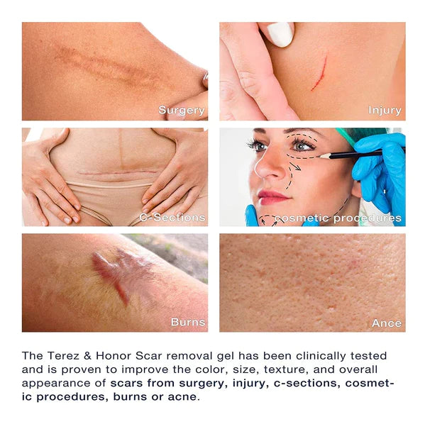 JAYSUING™ Advanced Silicone Skin Renewal Gel