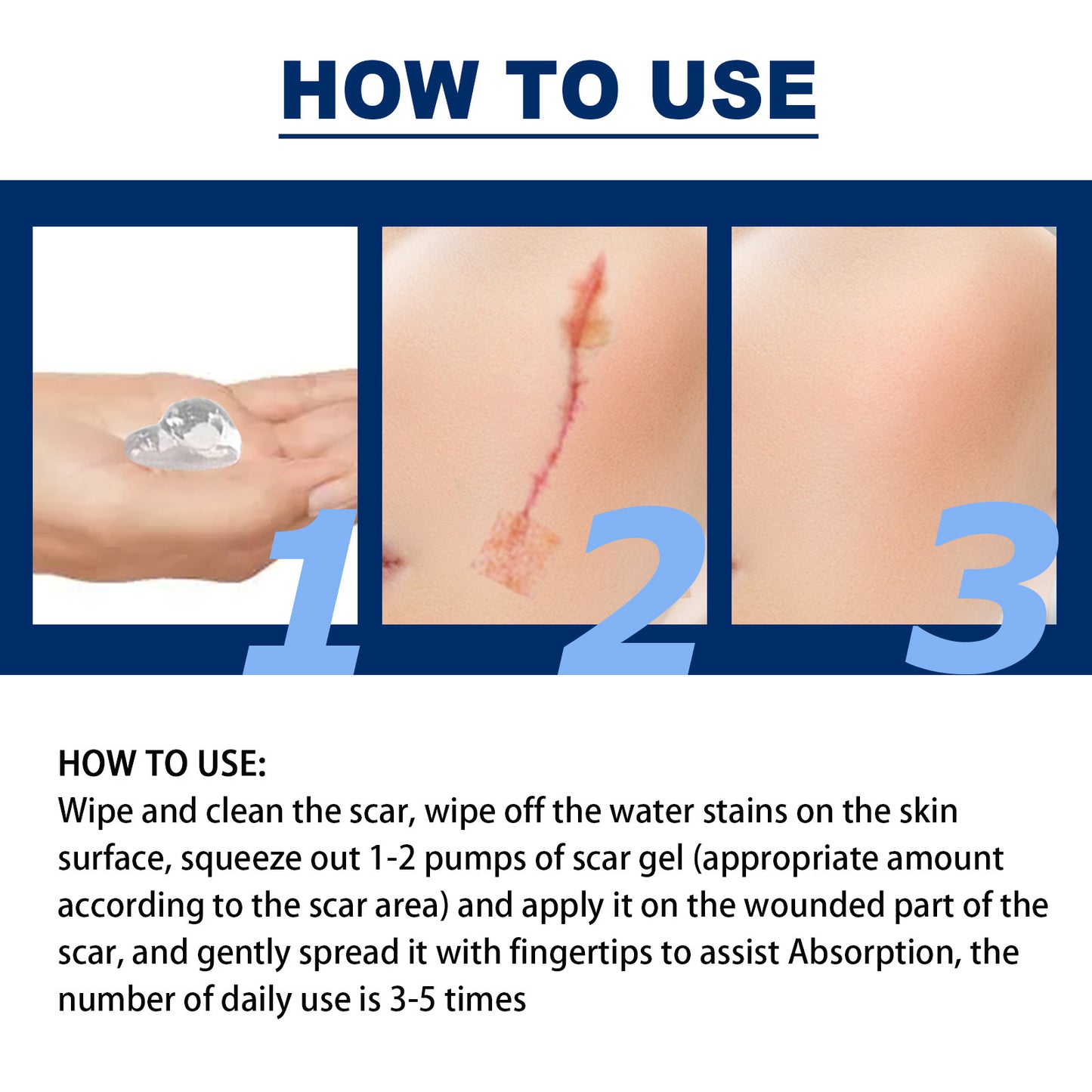 JAYSUING™ Advanced Silicone Skin Renewal Gel