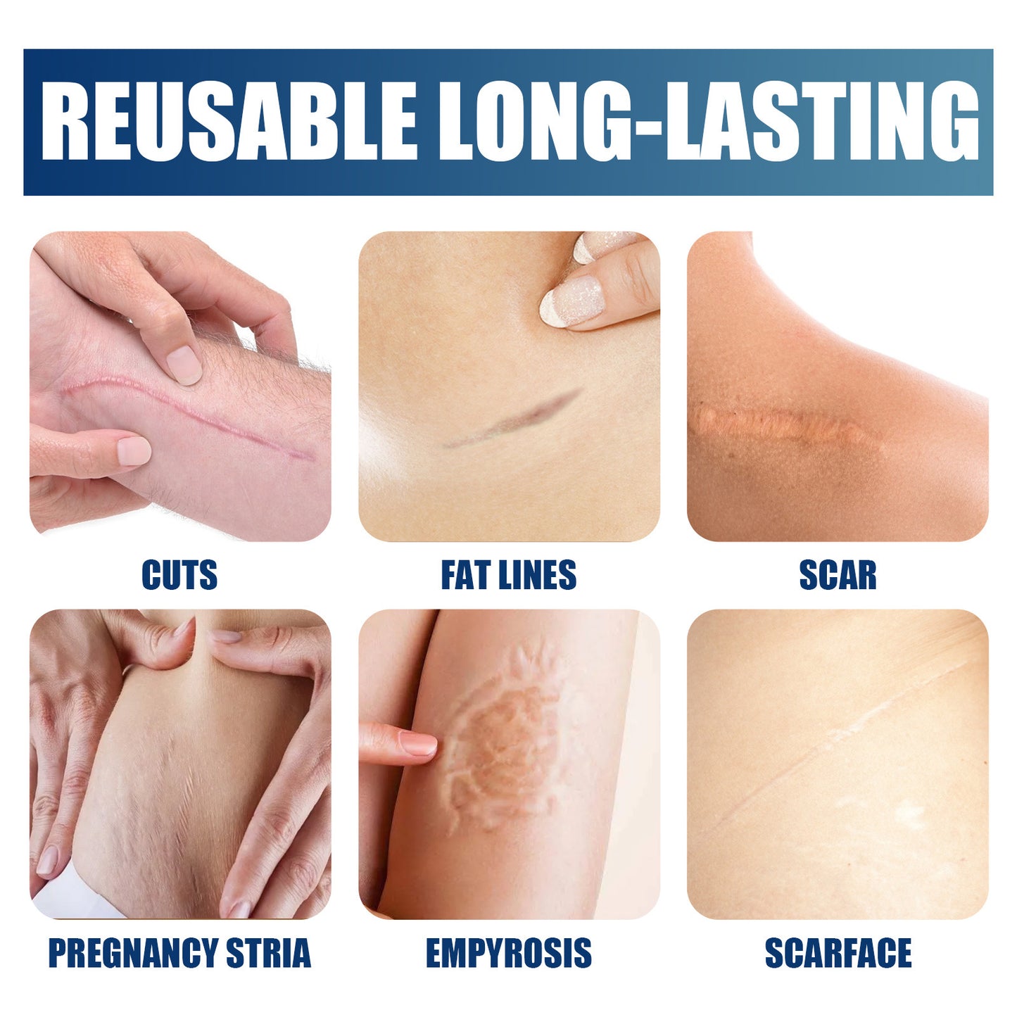 JAYSUING™ Advanced Silicone Skin Renewal Gel